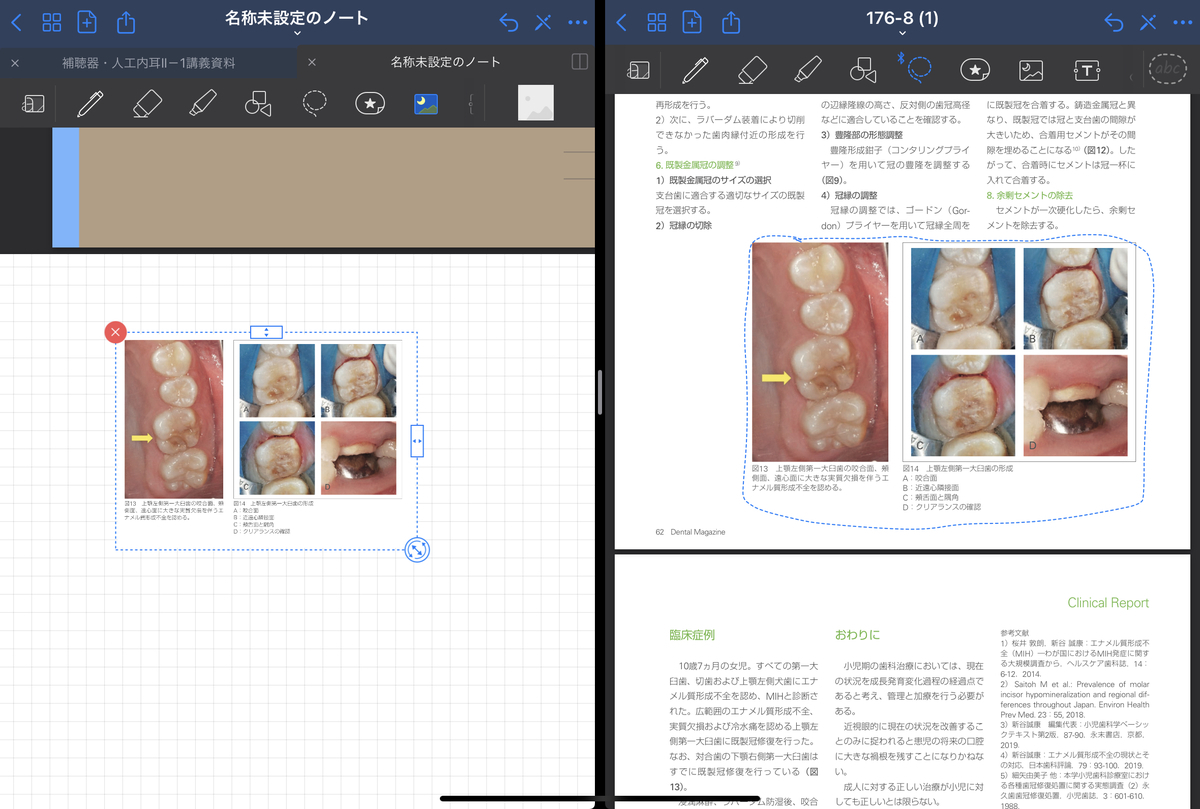 f:id:takashineozeon:20210515213818j:plain