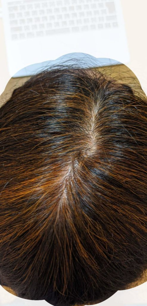 f:id:takecoco2004:20210322223534p:plain