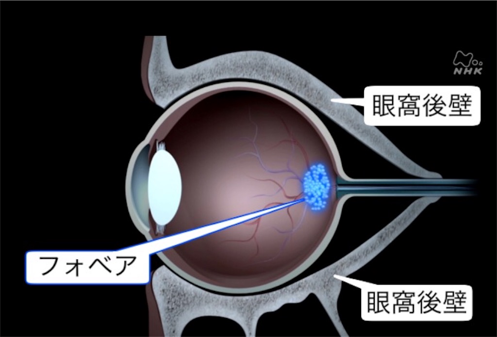 f:id:takeo1954:20170320083616j:image