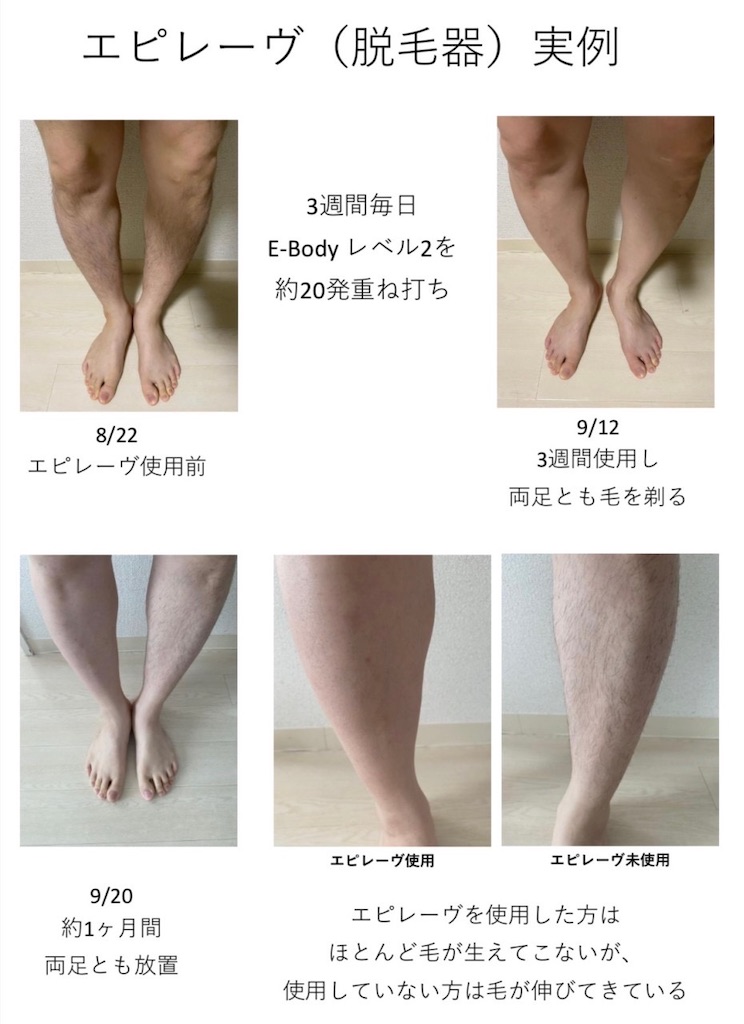 f:id:takeshi10:20230616154652j:image