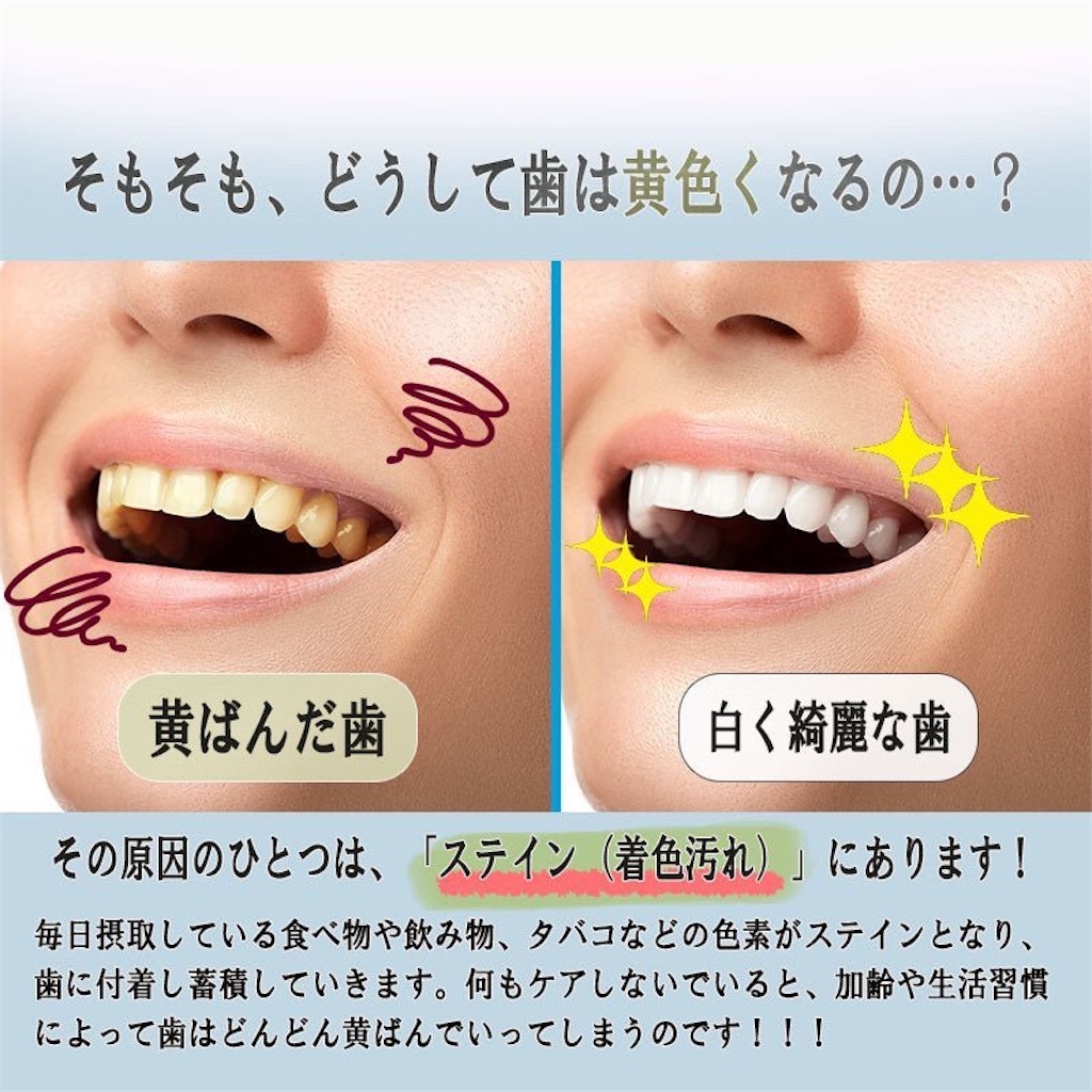 f:id:takeshi10:20251030134553j:image f:id:takeshi10:20251030134553j:image