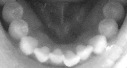 f:id:takiman:20190416120830j:plain