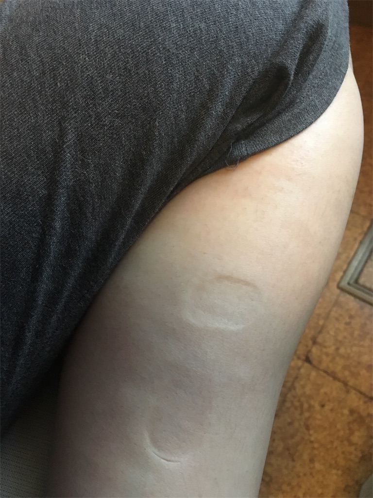 f:id:takki_bear:20180701165821j:image