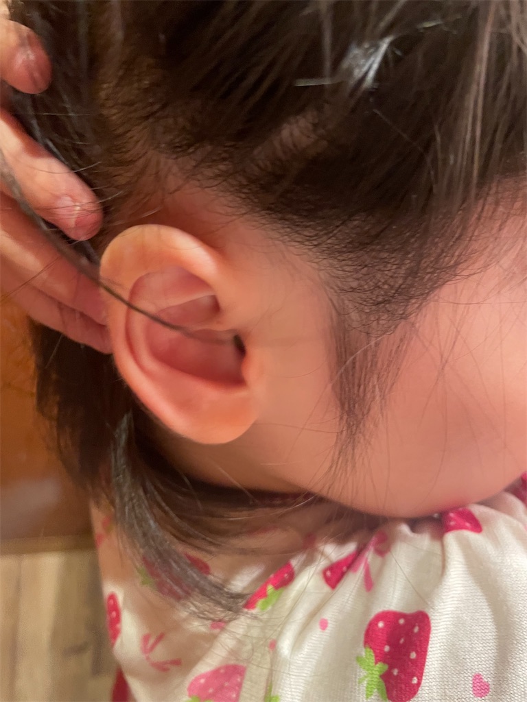 f:id:takki_bear:20240726061433j:image f:id:takki_bear:20240726061433j:image