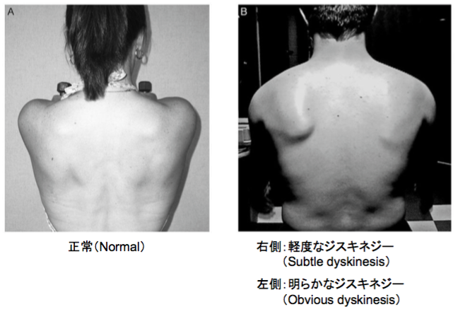 f:id:takumasa39:20170130131455p:plain f:id:takumasa39:20170130131455p:plain