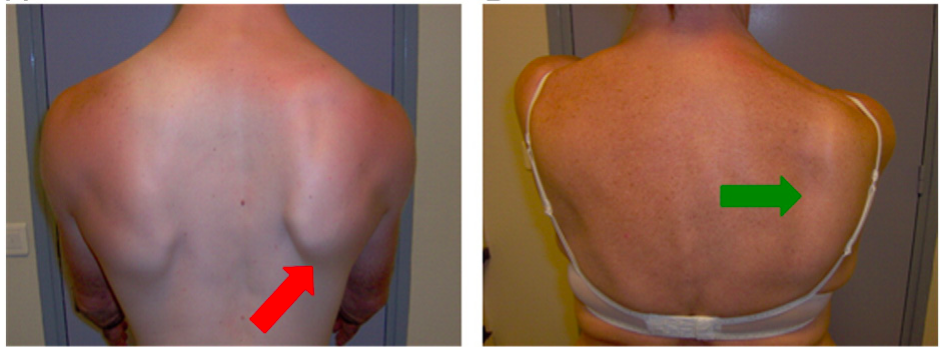 f:id:takumasa39:20170210124744p:plain