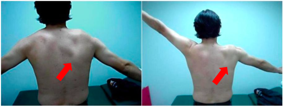 f:id:takumasa39:20170210125258p:plain