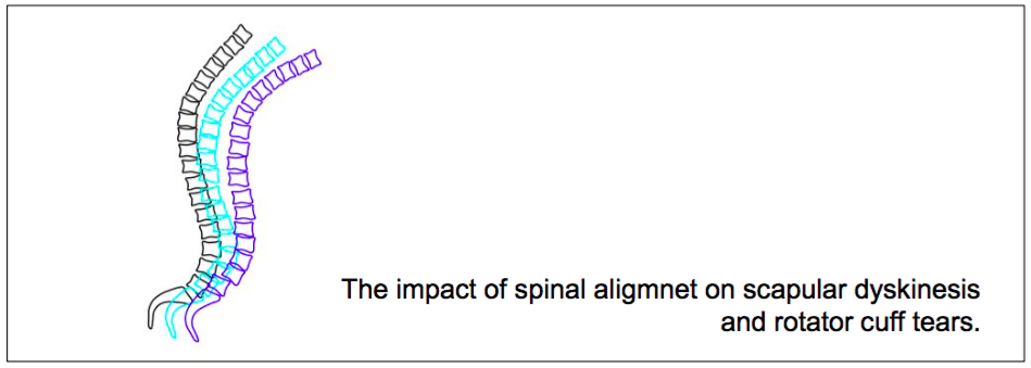 f:id:takumasa39:20170223142956p:plain