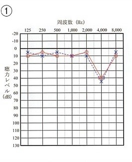 f:id:takuwaning:20191101232603j:plain