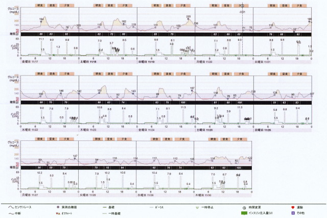 f:id:taky5566:20171206233102j:plain f:id:taky5566:20171206233102j:plain