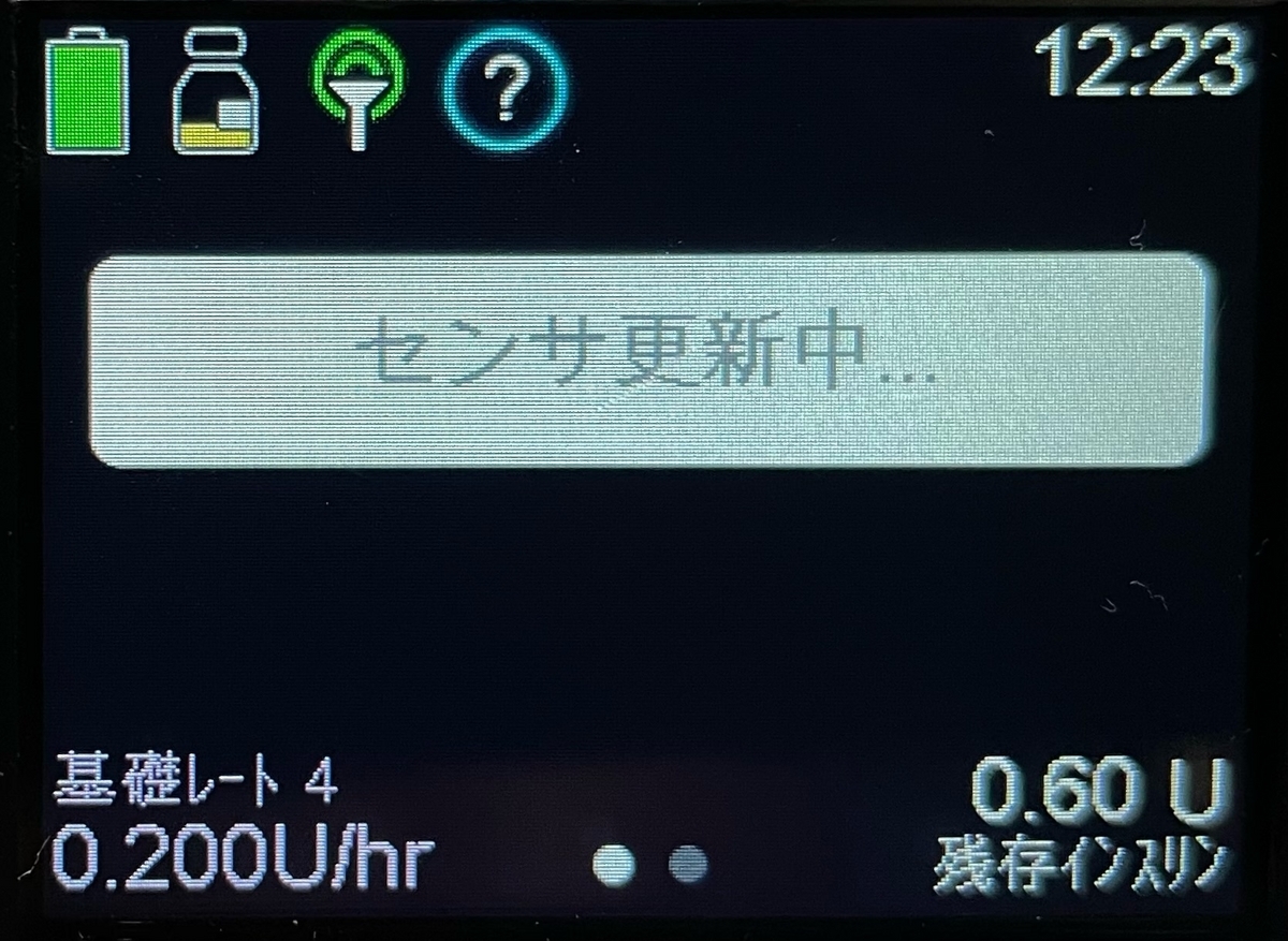 780Gの不良センサ：「センサ更新中」と「要センサ交換」 - 1型