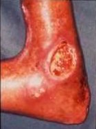 f:id:takyamamoto:20170627125920p:plain