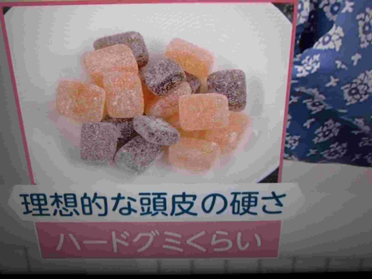 あさイチ・頭皮ケア