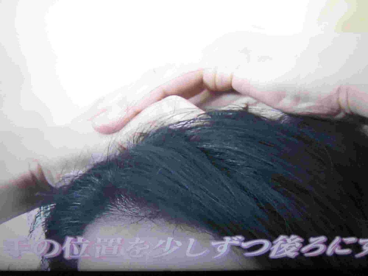 あさイチ・頭皮のセルフチェック