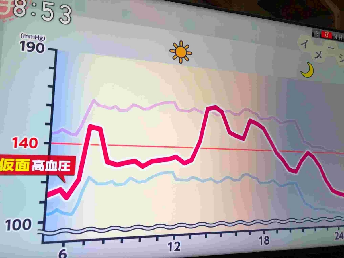 あさイチ・脳卒中