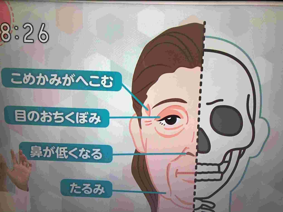 あさイチ・骨やせ予防