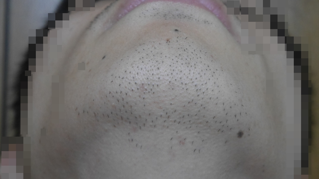 f:id:tanotanonikki:20181103205010j:plain f:id:tanotanonikki:20181103205010j:plain