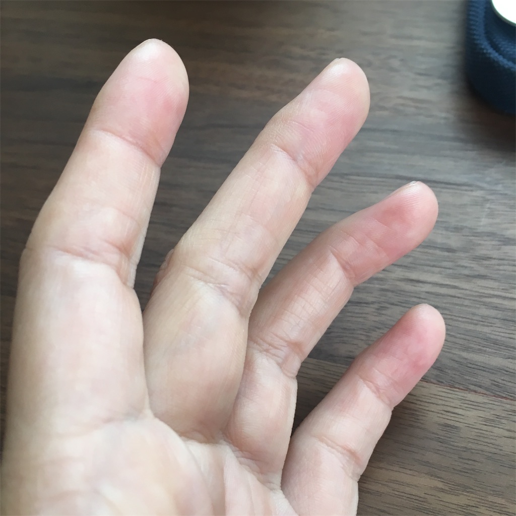 f:id:taoyaka2:20181111121508j:plain f:id:taoyaka2:20181111121508j:plain