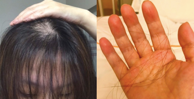 脱毛が始まりましたので新しいウィッグ書いましたよ〜楽しみ♪ またレビューしますね＾＾