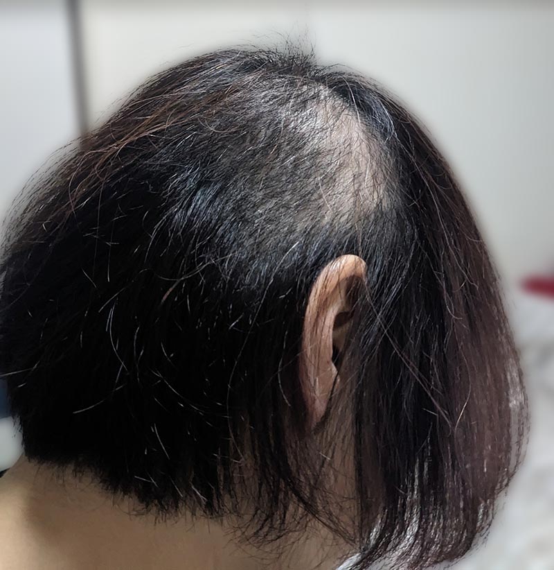 20230215抜毛状況