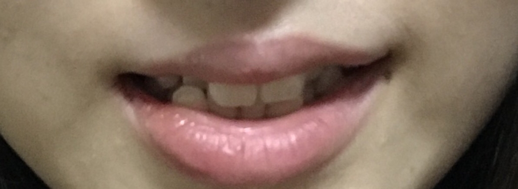 f:id:tatakauolchan:20180902220852j:plain f:id:tatakauolchan:20180902220852j:plain