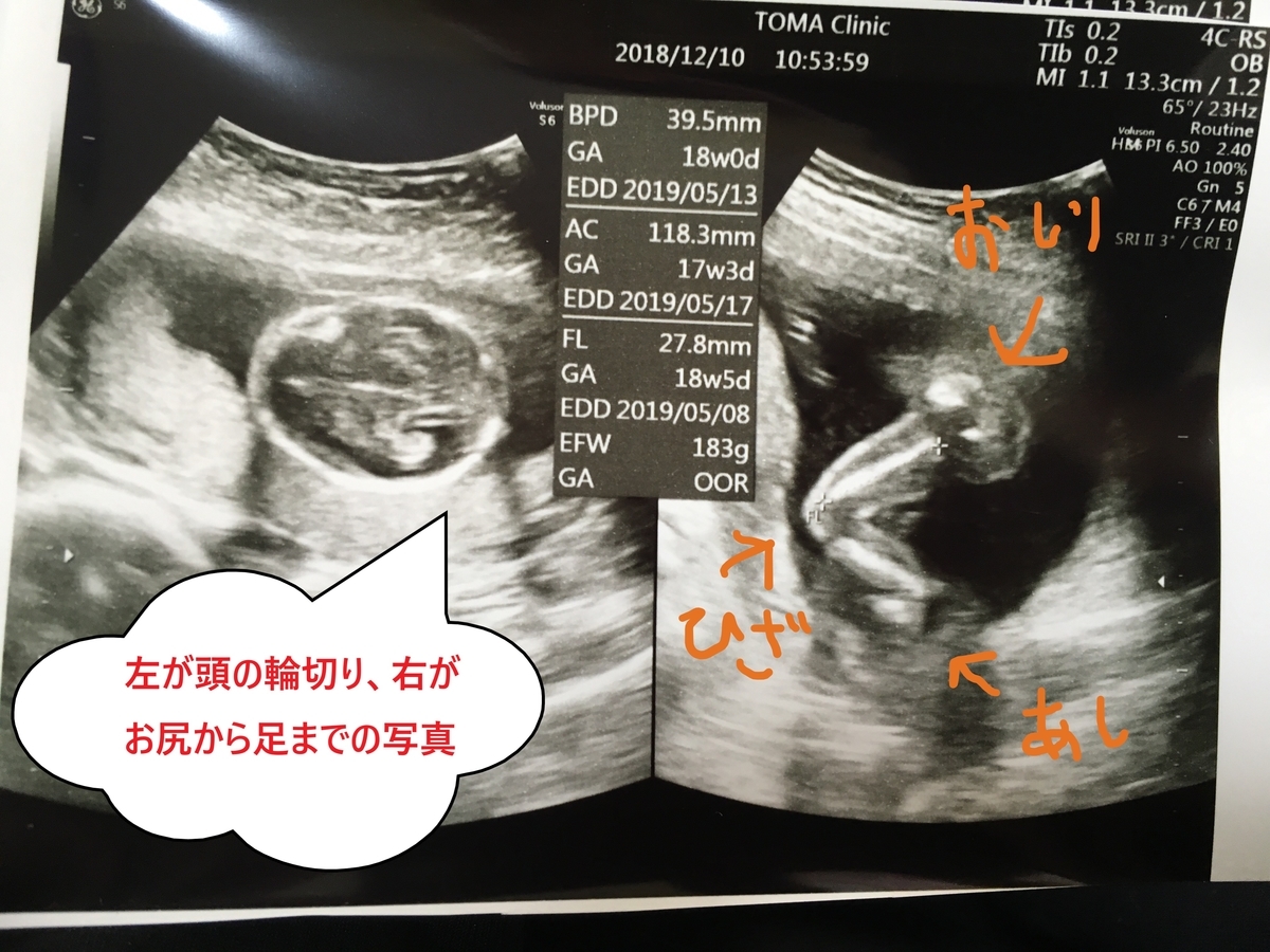 エコー写真の見方と推移 お茶充生活