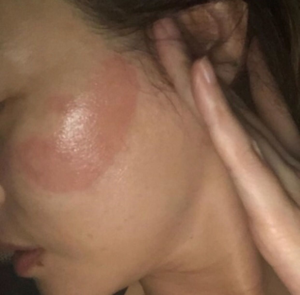 女優キムソンリョン アイマスク副作用 赤く腫れた衝撃的な顔の傷を公開 韓information