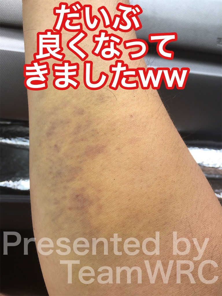 f:id:teamwrc:20200805000003j:image f:id:teamwrc:20200805000003j:image