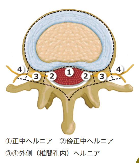 f:id:tenio:20220115074643p:plain