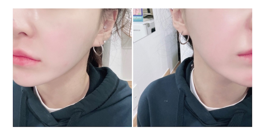 f:id:tentechjapan:20220106114307j:plain