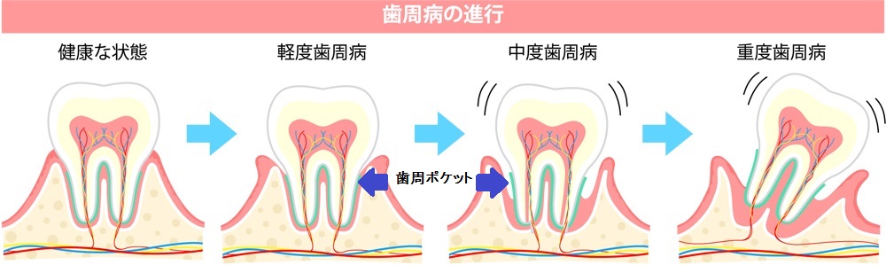 f:id:tentsu_media:20190418113256j:plain f:id:tentsu_media:20190418113256j:plain