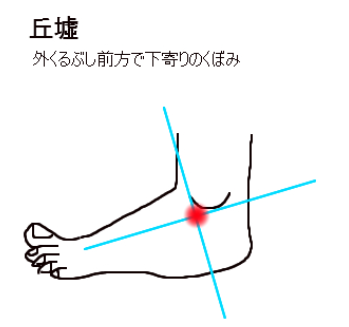 f:id:terupianist:20170516160845p:plain