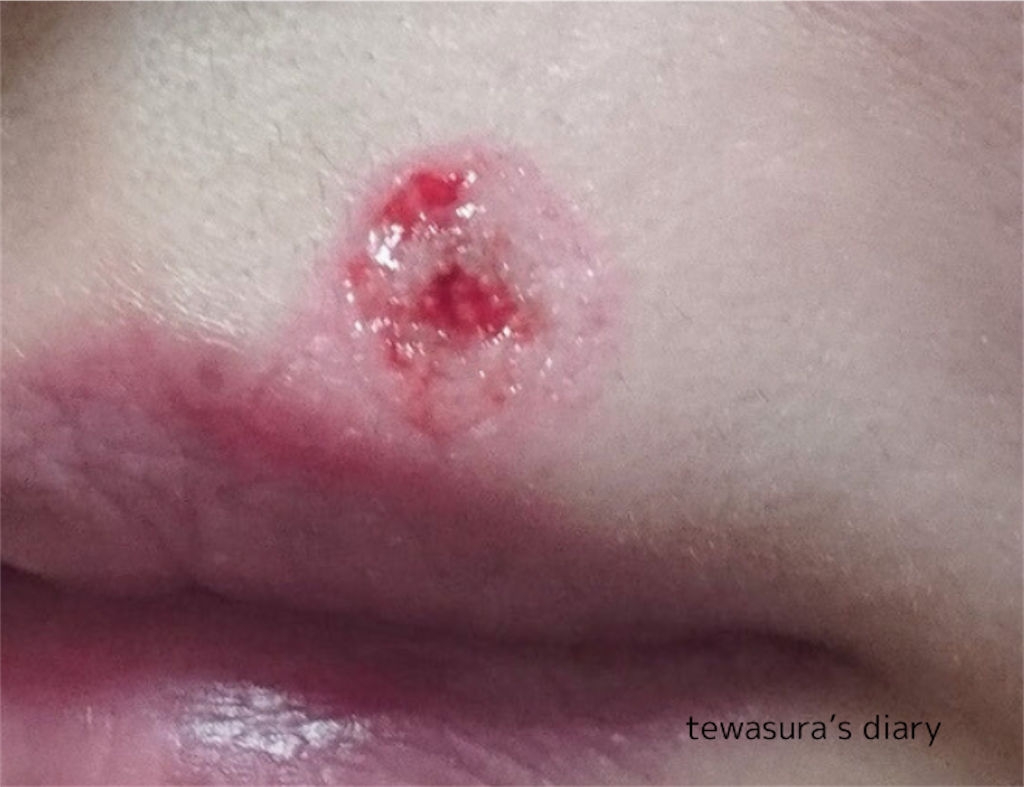f:id:tewasura:20250426212909p:image f:id:tewasura:20250426212909p:image