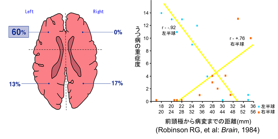 f:id:therapilasis:20180420125414p:plain f:id:therapilasis:20180420125414p:plain