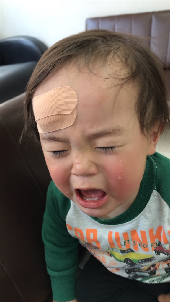 巣ごもり中でも怪我はする １歳児の子育て すぎおろぐ
