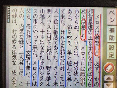 線の重複はもちろん、語句を丸で囲むこともできる