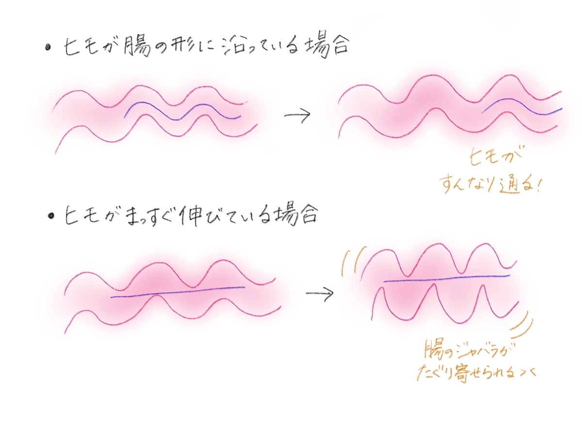 腸内の紐のイメージ図