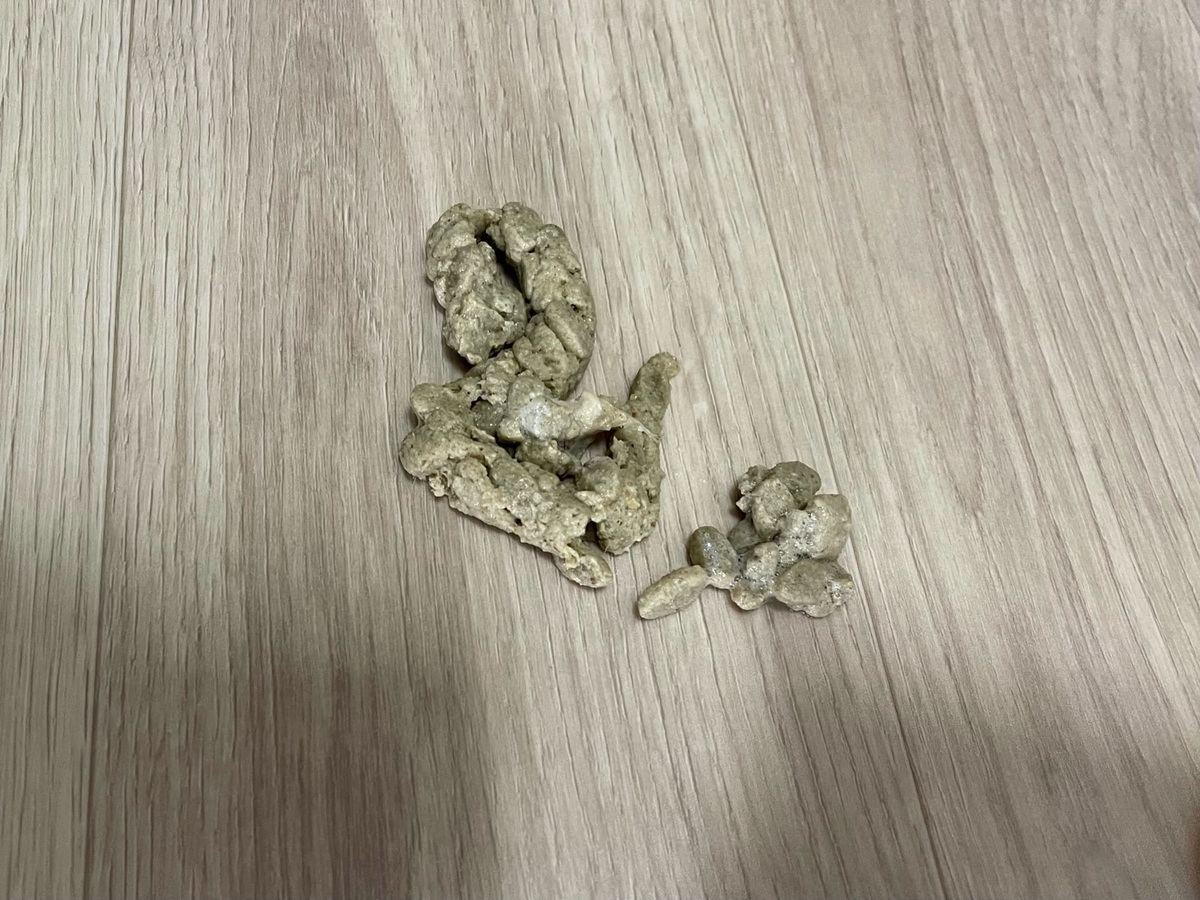 吐き戻し2