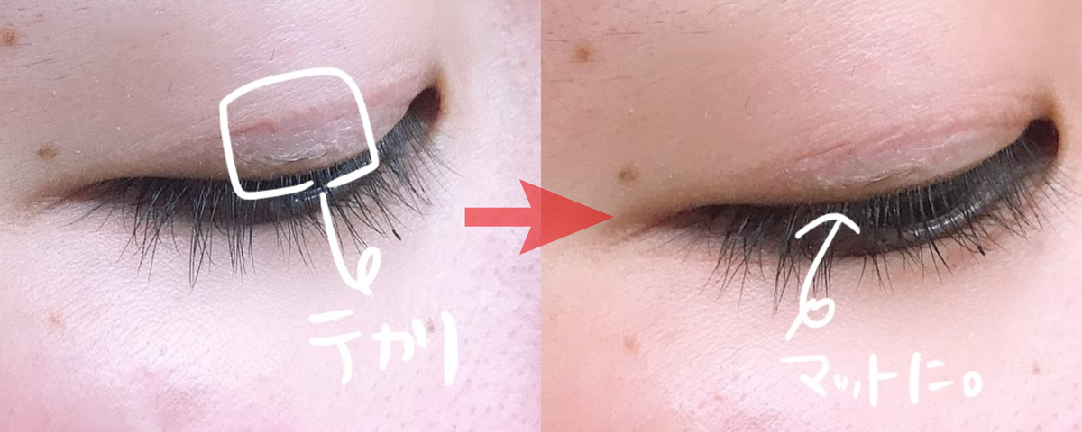 アイプチしてるのわからなかった お世辞抜きでこの言葉をもらえる方法 今までずっと目つきが悪いと馬鹿にされてきた一重ブスだった女子高生が １日取れない理想の二重を作り上げて 憧れのあの人とも自信を持って話せるようになった ほぼ整形アイプチ方法