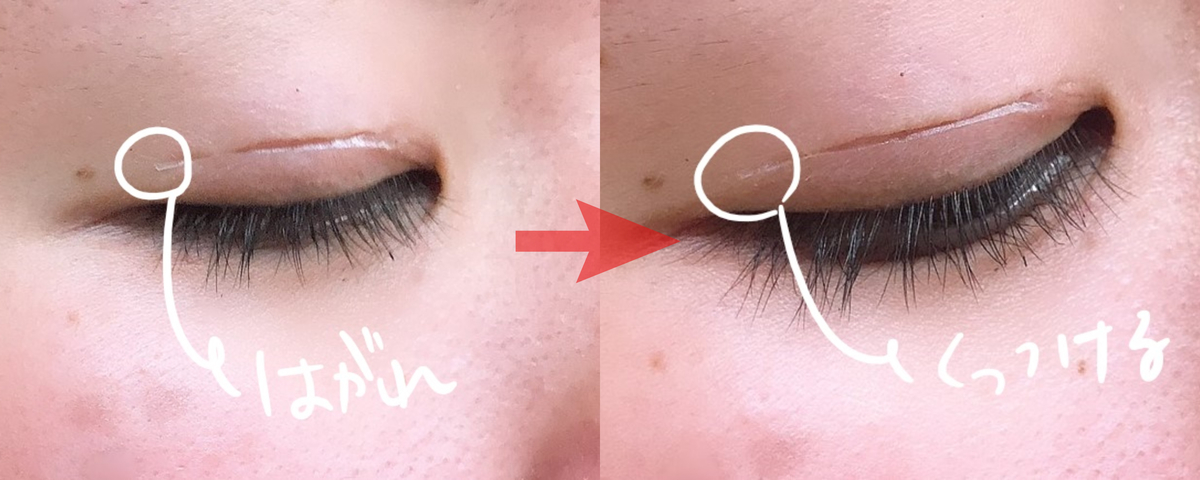 アイプチしてるのわからなかった お世辞抜きでこの言葉をもらえる方法 今までずっと目つきが悪いと馬鹿にされてきた一重ブスだった女子高生が １日取れない理想の二重を作り上げて 憧れのあの人とも自信を持って話せるようになった ほぼ整形アイプチ方法