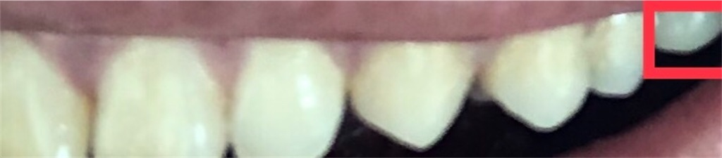 f:id:tkHoumu:20200909154317j:plain f:id:tkHoumu:20200909154317j:plain