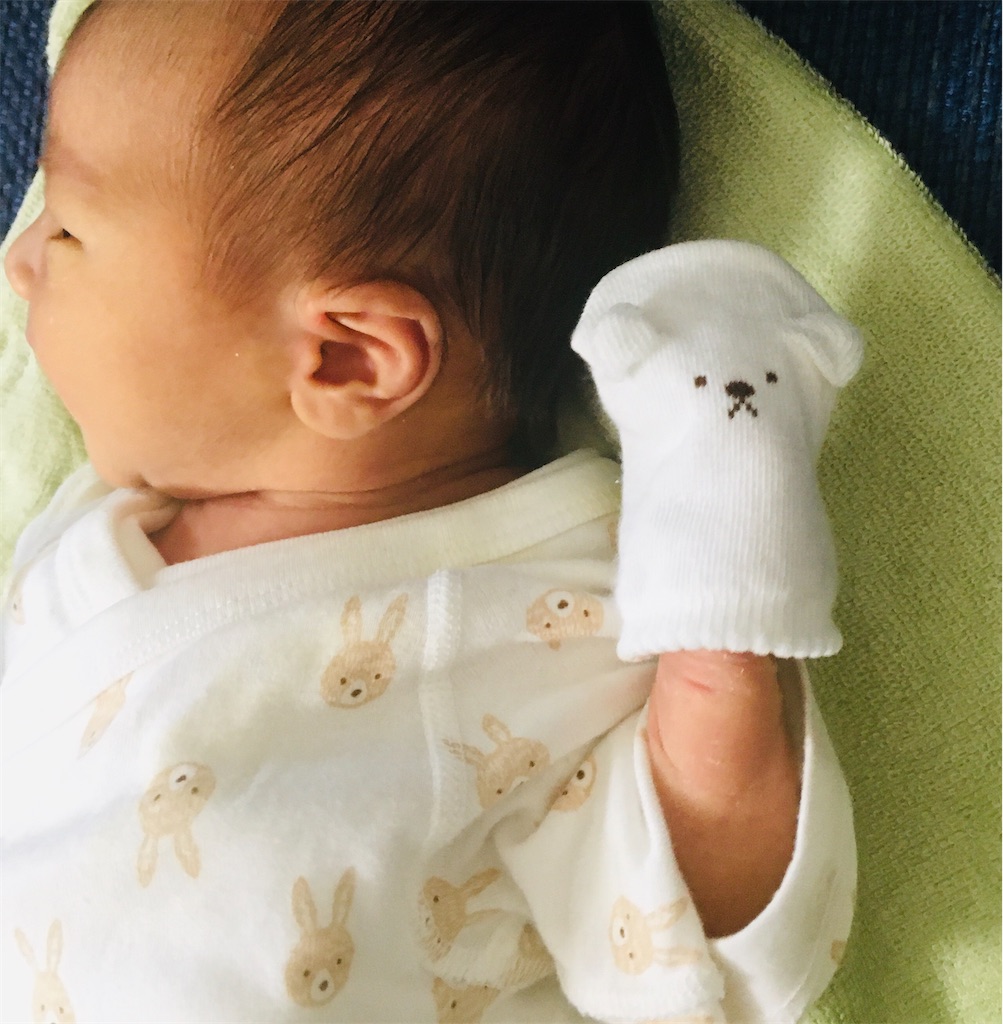 黄疸の再検査と息子の体重 ネコパンチ対策にミトン導入しました まいにちきろくノート 黄疸の再検査と息子の体重 ネコパンチ対策にミトン導入しました まいにちきろくノート