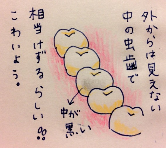 f:id:tocotocokumachan:20170702095145j:plain