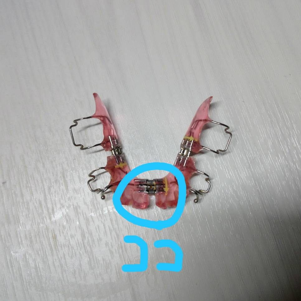 f:id:toguri-dental:20180921005222j:plain