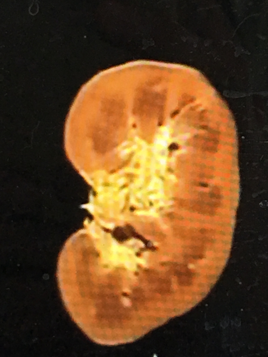 f:id:tomaatlas:20190628163414j:plain