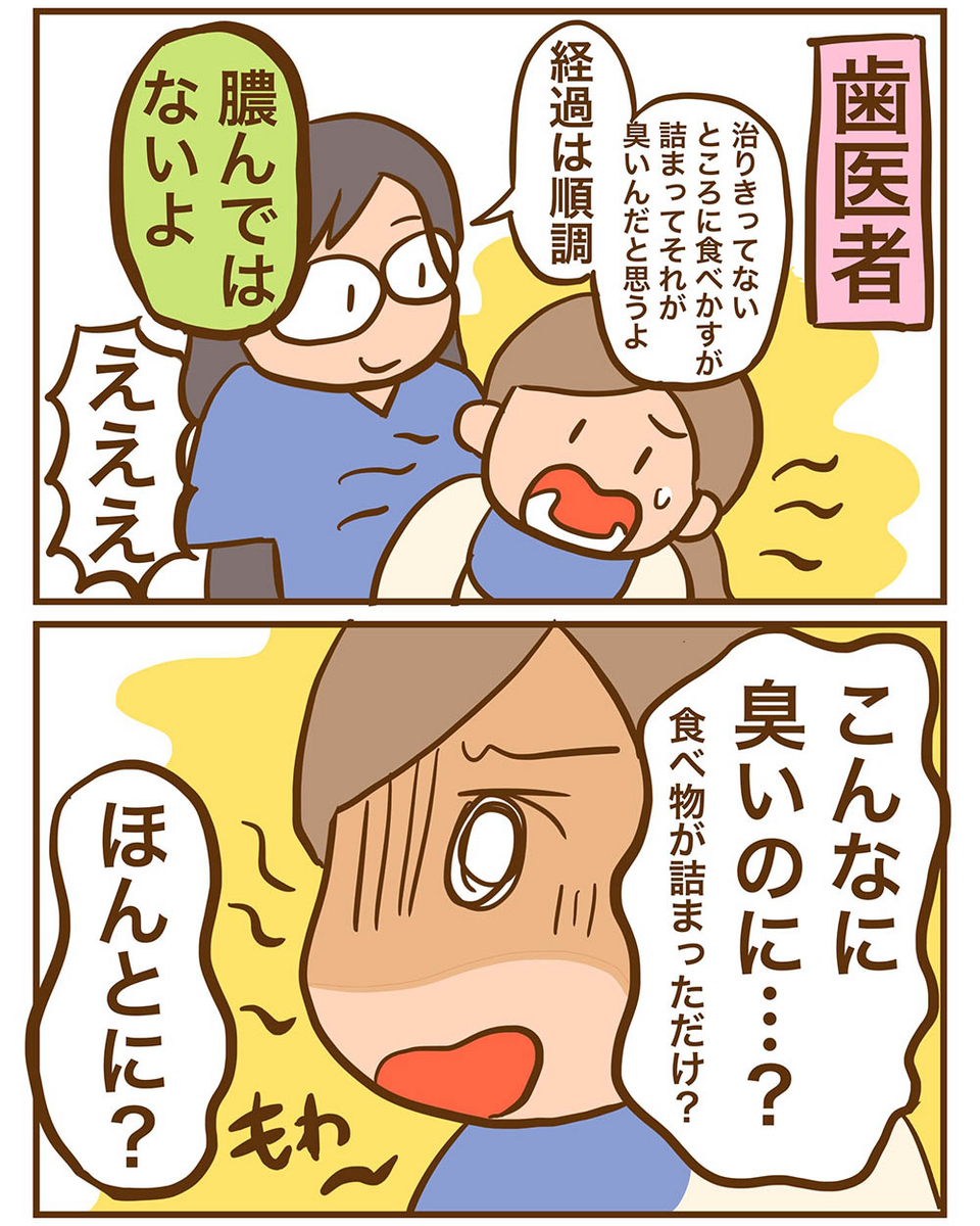 親知らず なん j