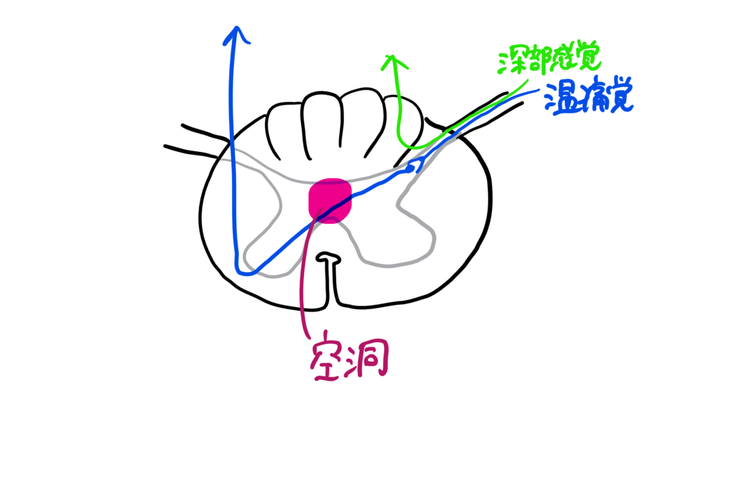 f:id:tomiri17:20170601012733p:plain