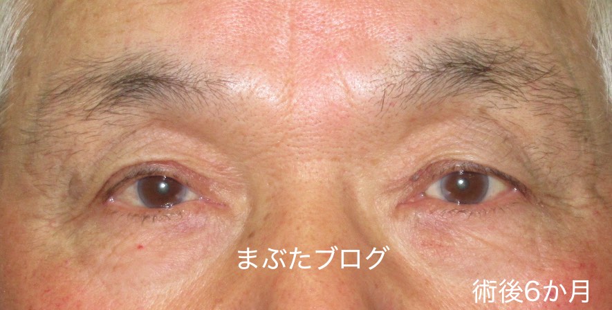 f:id:tomitooji:20171218193749j:plain