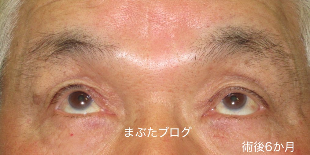 f:id:tomitooji:20171218194133j:plain
