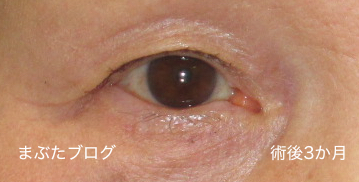 f:id:tomitooji:20180106181930j:plain